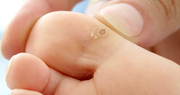 helmintox sirop pret în cazul în care un copil este vaccinat împotriva papilomelor